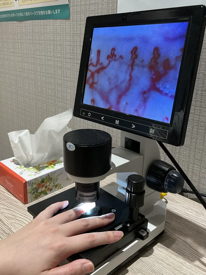 血管スコープで指先の毛細血管をモニターに映している様子