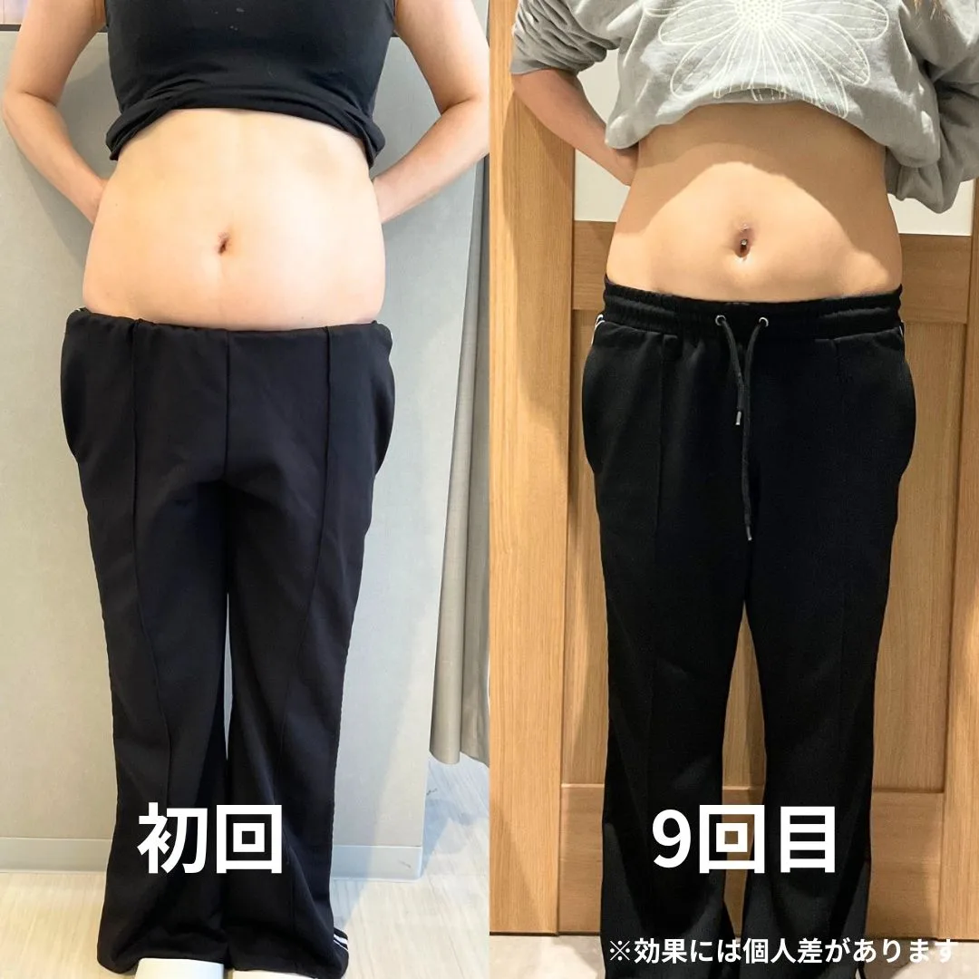 痩身メニュー 施術前後の変化(正面)